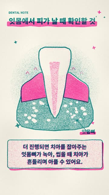 리소그래프 2색 1